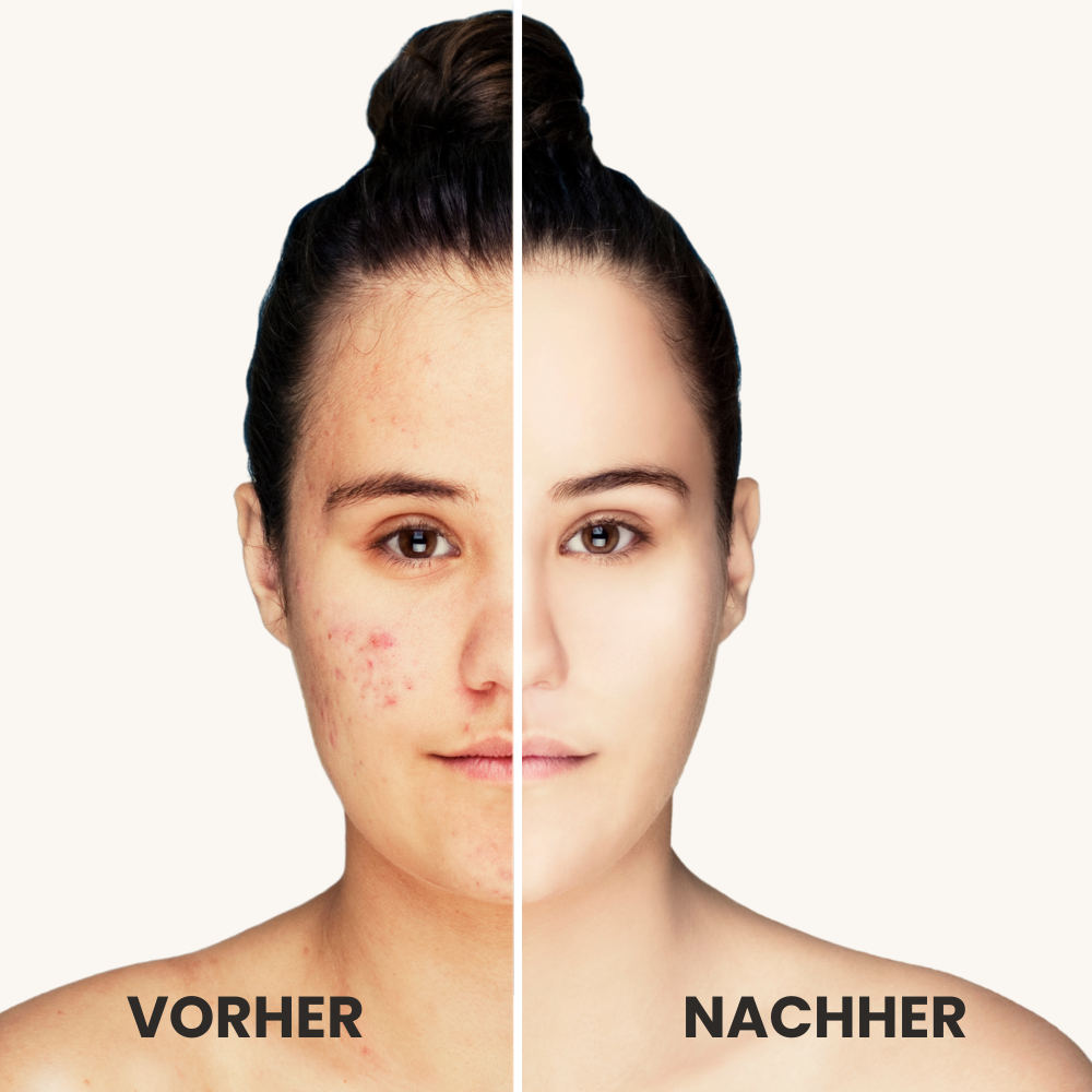 elviora - GlowPulse Pro