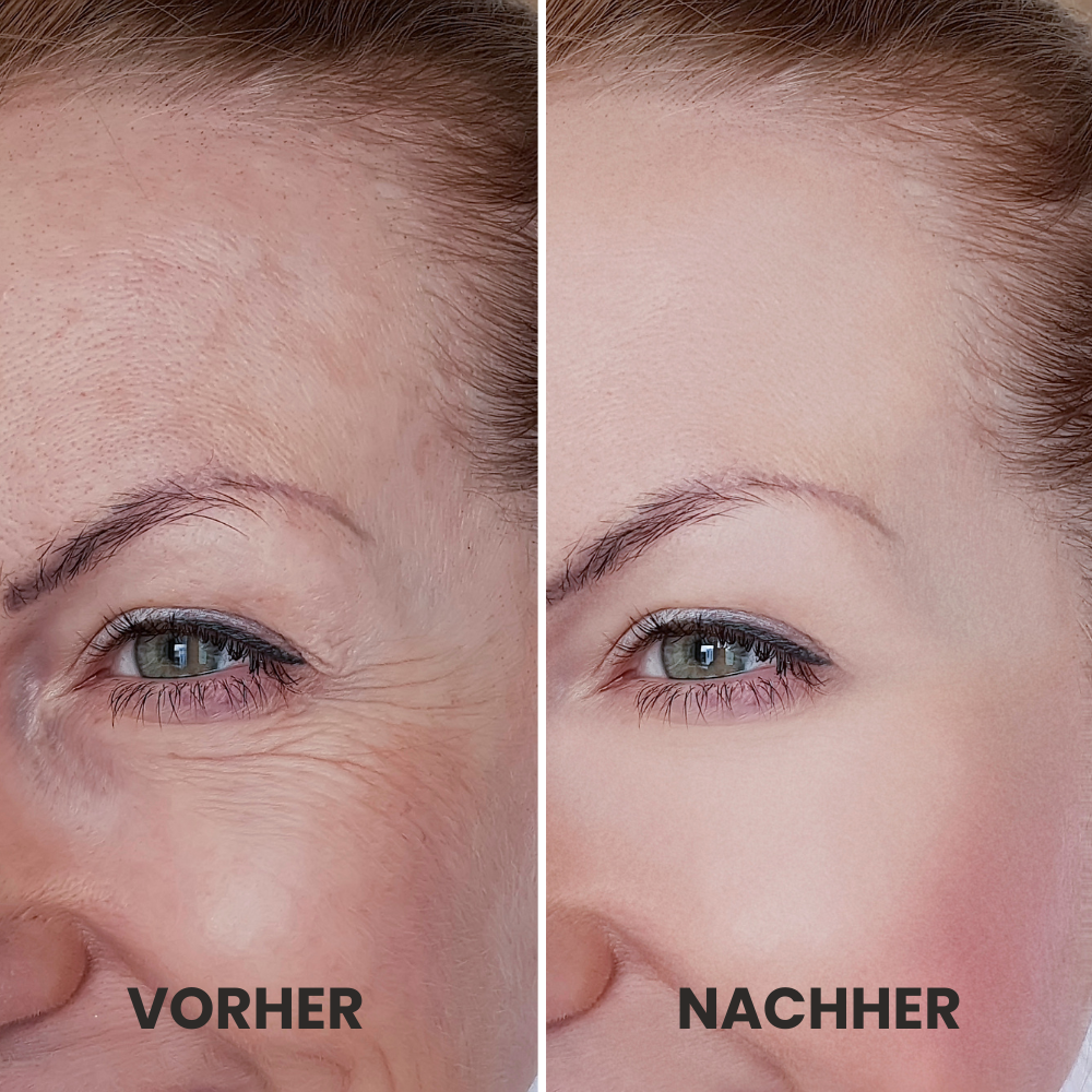 elviora - GlowPulse Pro